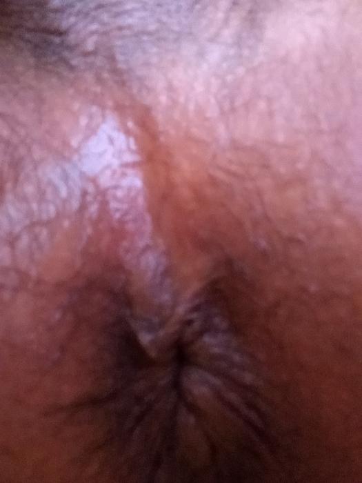 Alex (34)