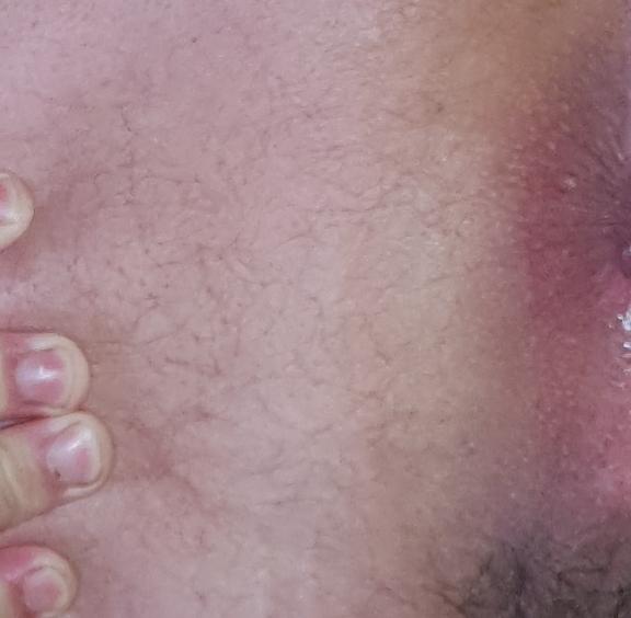 MrHetero (33)