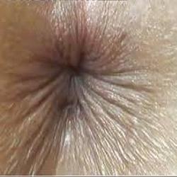 Re