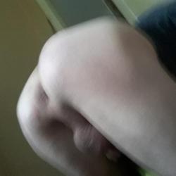 Anal