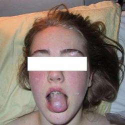 18gadniece