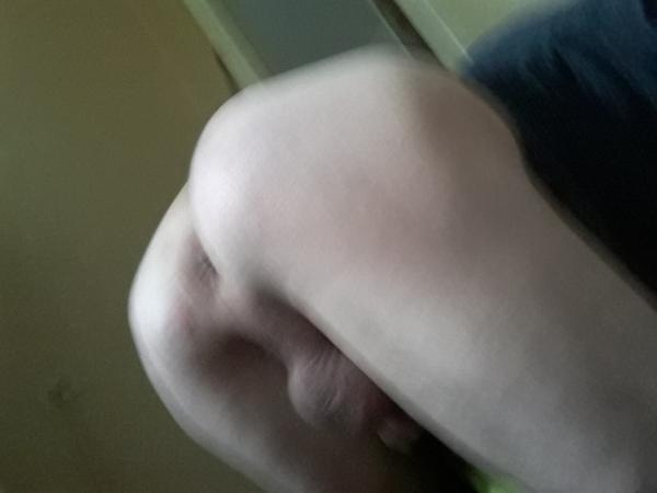 Anal (69)