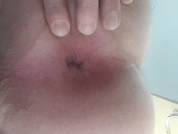 anon (32)