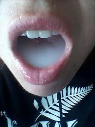 Zigis (32)