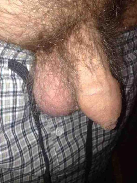 Balls (41)