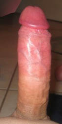 Liels (36)