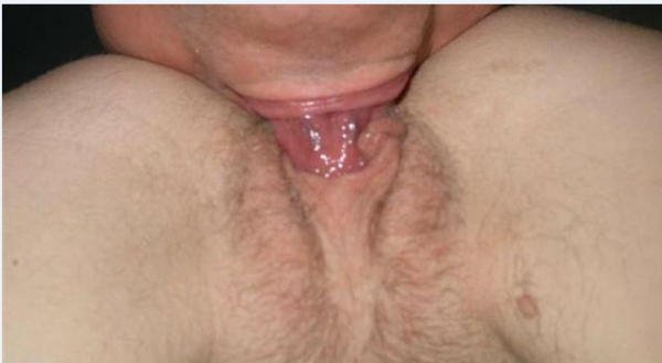 Dondigidon (46)