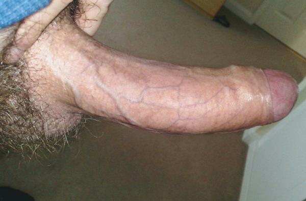 P (37)