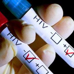 Hiv+