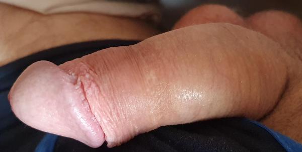  (38)
