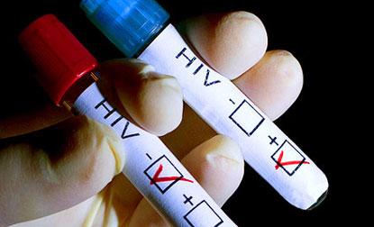 Hiv+ (35)