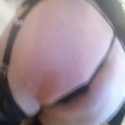 CD anal
