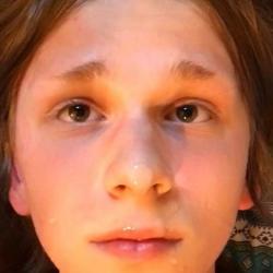young oral