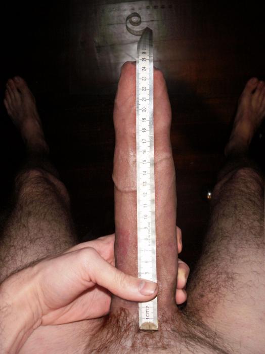  (38)