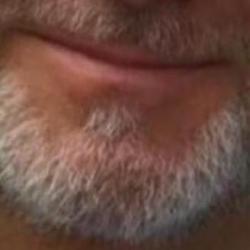 Oral,sperm