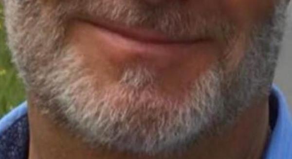 Oral,sperm (52)