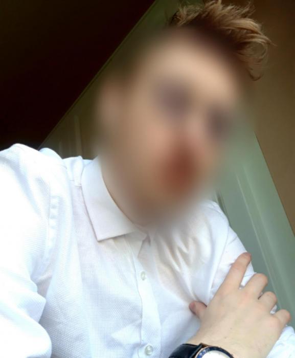 Ben (25)