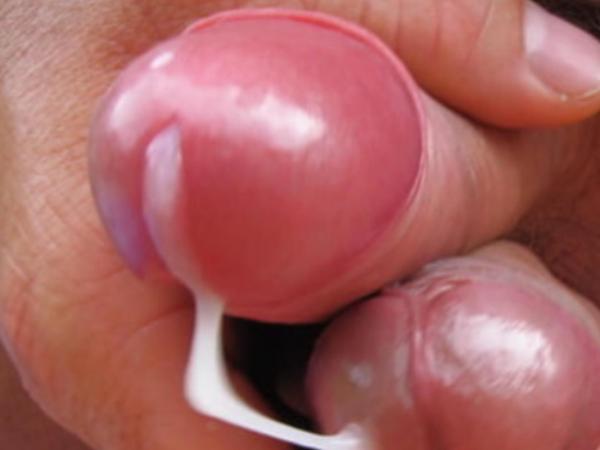 Oral 69 (53)