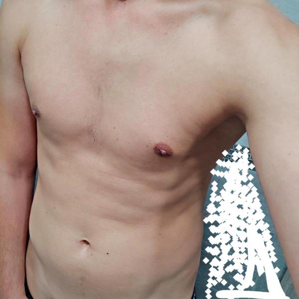 tomass (31)